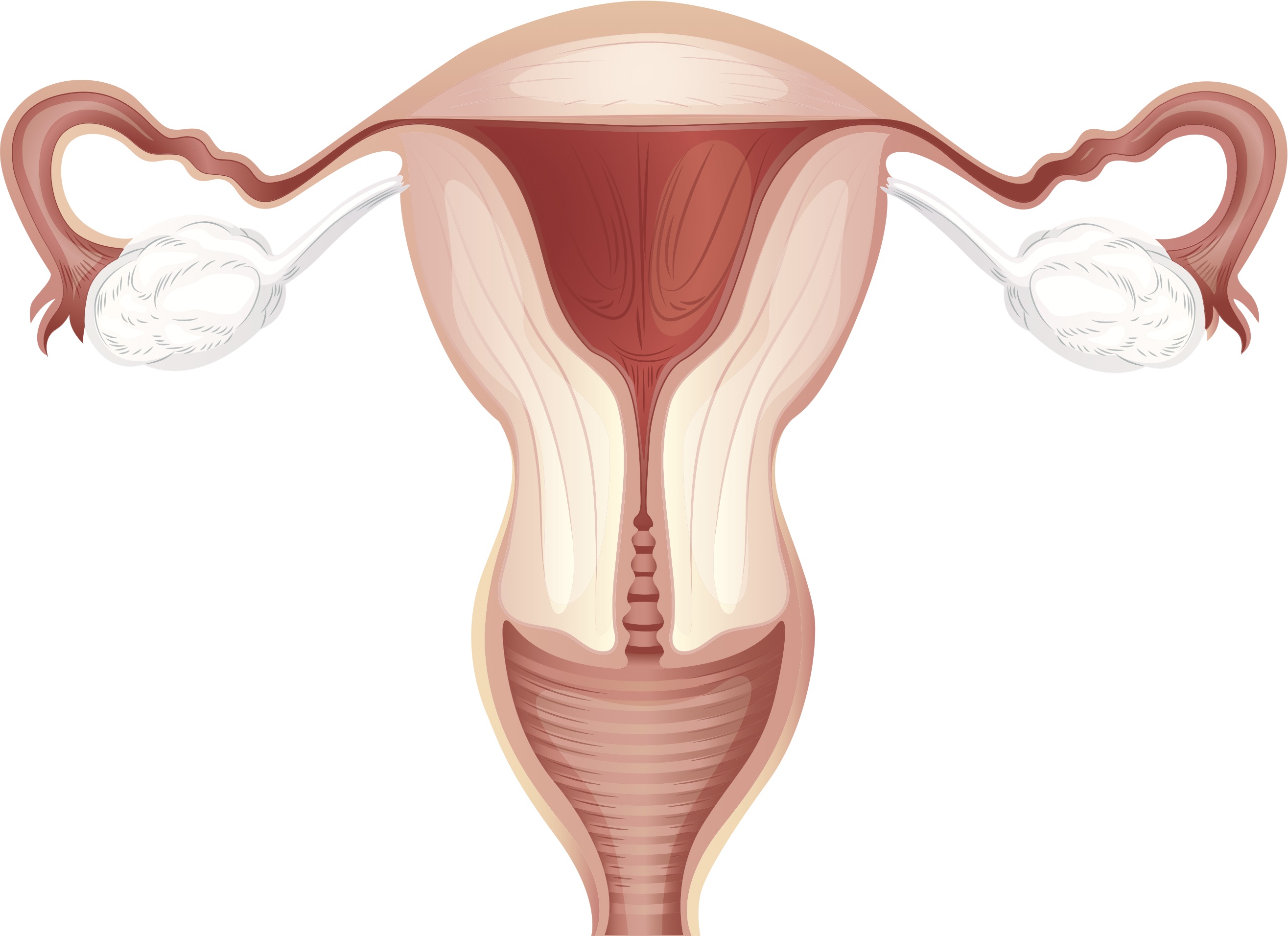 Методы эффективного лечения миомы матки